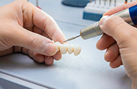歯科技工士が補綴物を製作する様子