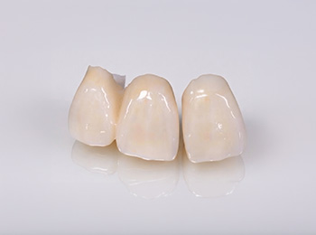 e-max製の歯科技工物